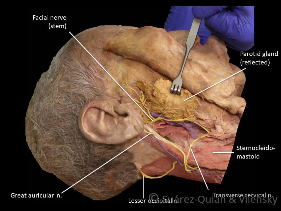 Dahlia reccomend main trunk facial nerve