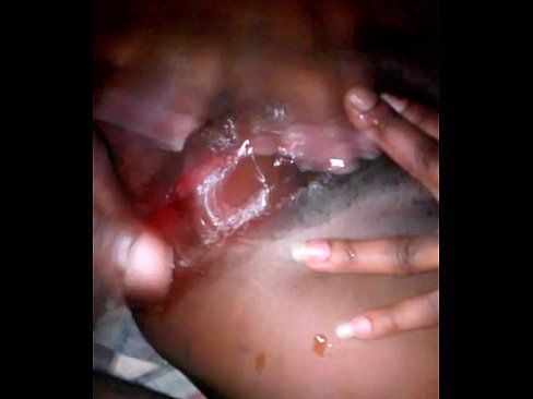 Bleeding vagina after sexual intercourse