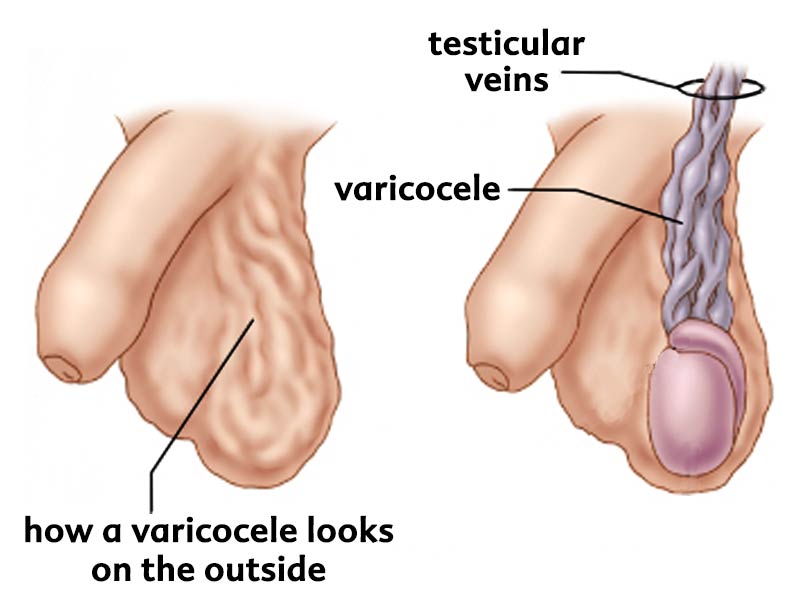 best of Count verices scrotum sperm