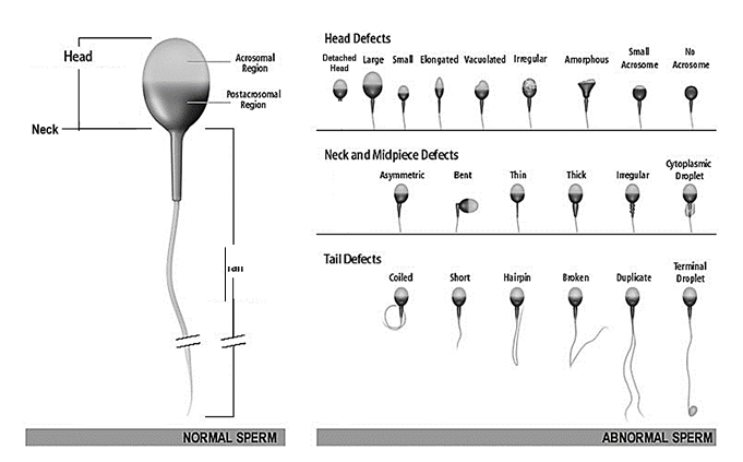 best of Evaluation sperm atlas human morphology