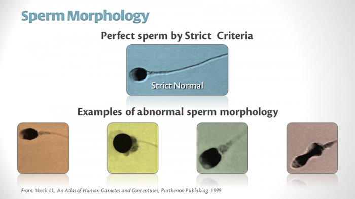 Atlas evaluation human morphology sperm