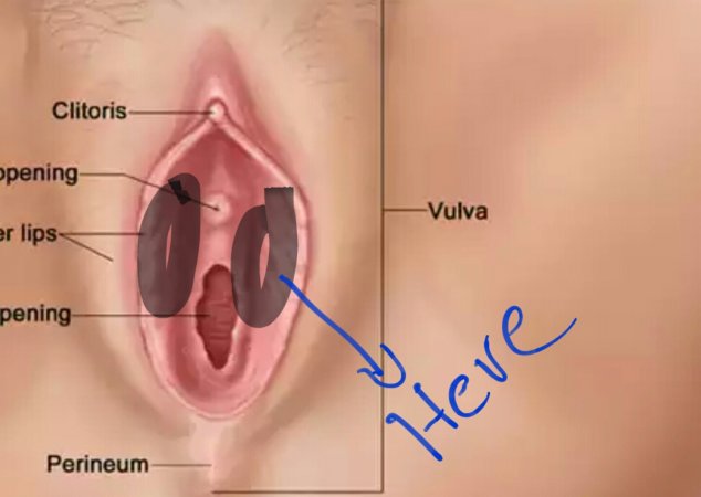 Hammer reccomend bumps above vagina free nude