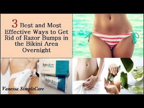 Snowdrop reccomend bikini line razor bump home