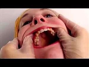 Henchman reccomend facial surface tooth